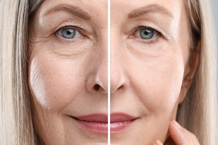senior woman anti aging beauty treatment face close up